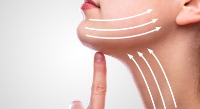 Fadenlifting – Sanfte Hautstraffung und Revitalisierung ohne OP