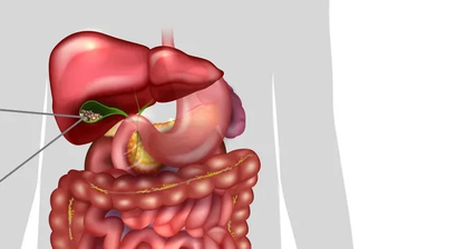 Gallenwegserkrankungen