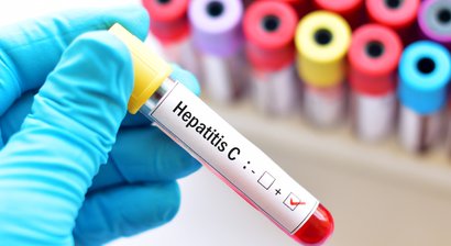 Akute und chronische Hepatitis