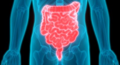 Divertikelkrankheit / Divertikulitis