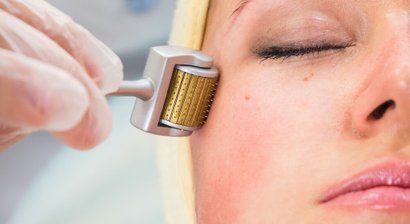 Microneedling mit Radiofrequenz