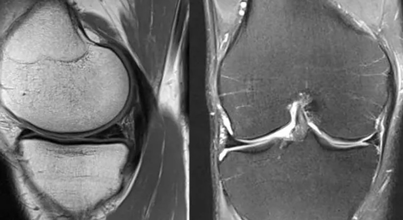 Arthroskopie - OA Dr. Clemens Hüthmair - Orthopäde Wien 1050