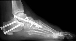 Univ. Prof. Dr. med. univ. Radek Hart, PhD., FRCS, MHA - Orthopäde Wien 1190