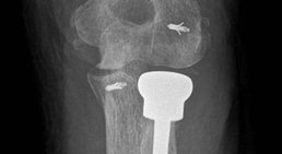 Univ. Prof. Dr. med. univ. Radek Hart, PhD., FRCS, MHA - Orthopäde Wien 1190