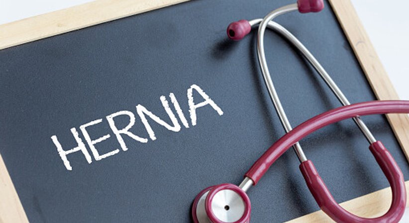 Minimalinvasive Chirurgie: Leistenbruch / Narbenbruch / Nabelbruch - Priv. Doz. Dr. Ruxandra Ciovica - Allgemeinchirurgin/Viszeralchirurgin Wien 1010