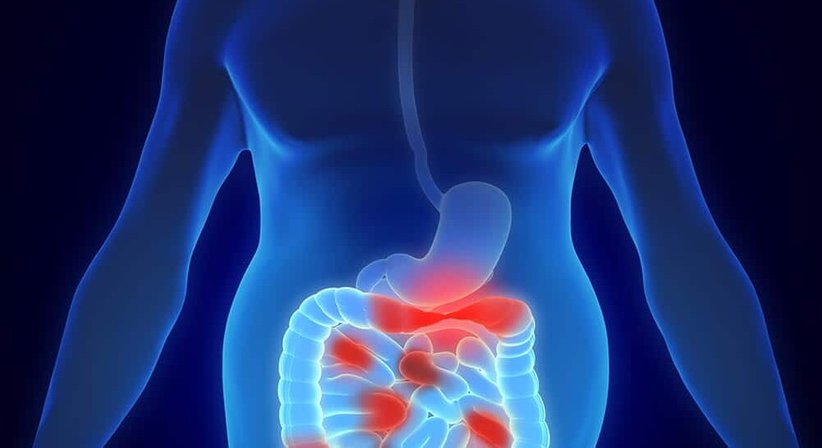 Operationen des Dünn- und Dickdarms - Priv. Doz. Dr. Ruxandra Ciovica - Allgemeinchirurgin/Viszeralchirurgin Wien 1010