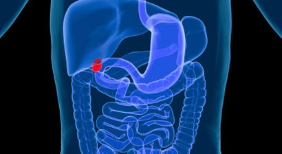 Chirurgie der Gallenblase