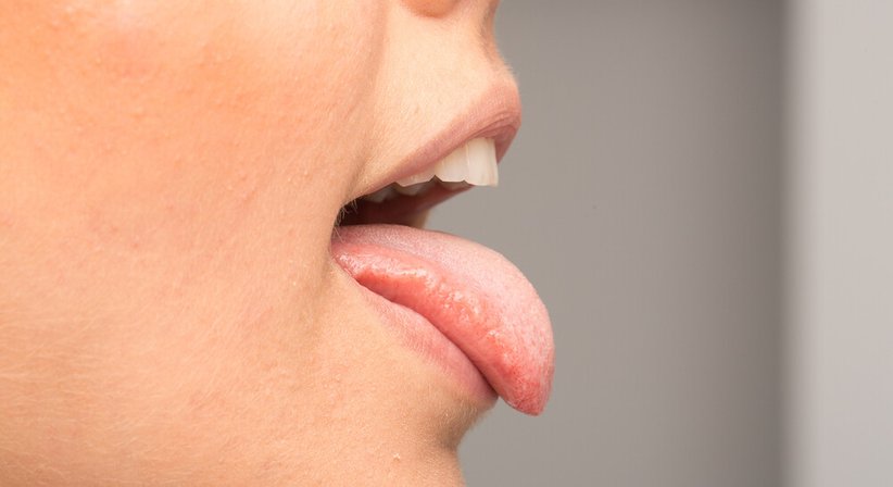 Speicheldrüsenerkrankung - Dr. Stefan Edlinger - HNO-Arzt Wien 1040