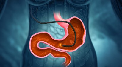 Endoskopie: Darmspiegelung/Coloskopie, Magenspiegelung/Gastroskopie, Proktoskopie, Rektoskopie 