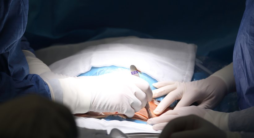 Krampfadern, Varizen, ambulante Kleinchirurgie - OA Dr. Alexis Freitas, F.E.B.S. - Allgemeinchirurg/Viszeralchirurg Wien 1090