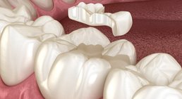 Dr. med. dent. Silke Spanlang, MSc - Zahnärztin Wien 1010