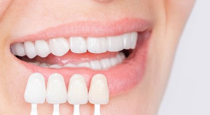 Ästhetische Zahnheilkunde