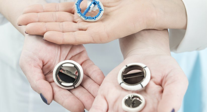 Klappenchirurgie - Univ.Prof. Dr. Marek Ehrlich - Allgemeinchirurg Wien 1190