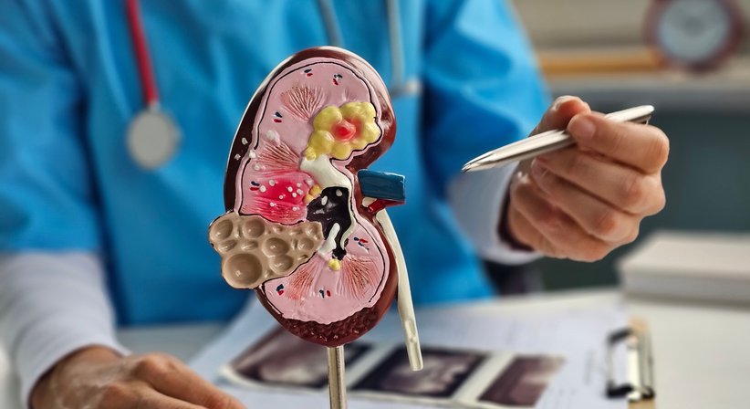 Harnsteine bei Uromed - Kompetenzzentrum für Urologie