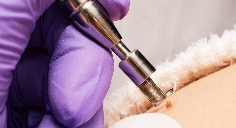 Sexualmedizin bei Uromed - Kompetenzzentrum für Urologie
