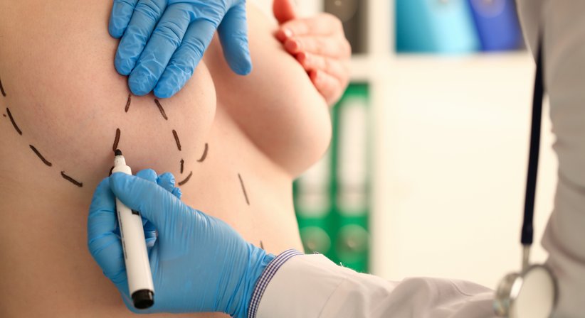 Brustverkleinerung - Dr. Thomas Giesler - Plastischer Chirurg Kitzbühel 6370