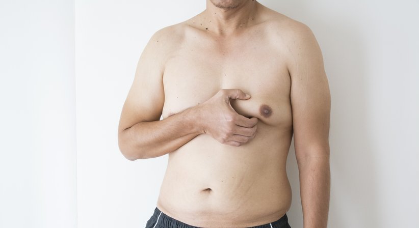 Gynäkomastie-OP (Brustverkleinerung beim Mann) - Dr. Thomas Giesler - Plastischer Chirurg Kitzbühel 6370