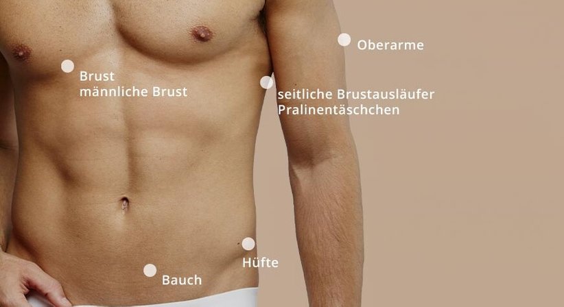 Fettweg-Spritze - Dr. Thomas Giesler - Plastischer Chirurg Kitzbühel 6370