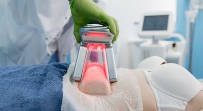 Kryolipolyse zur Behandlung von kleinen Fettpölsterchen