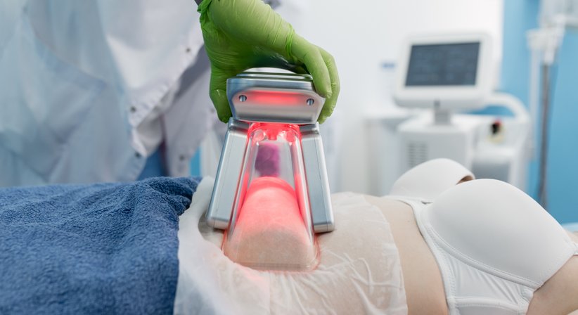 Kryolipolyse zur Behandlung von kleinen Fettpölsterchen - Dr. Thomas Giesler - Plastischer Chirurg Kitzbühel 6370