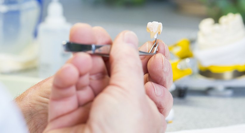 Inlays / Onlays - Dr. Andreas Zimmermann - Zahnarzt Rohrbach bei Mattersburg 7222