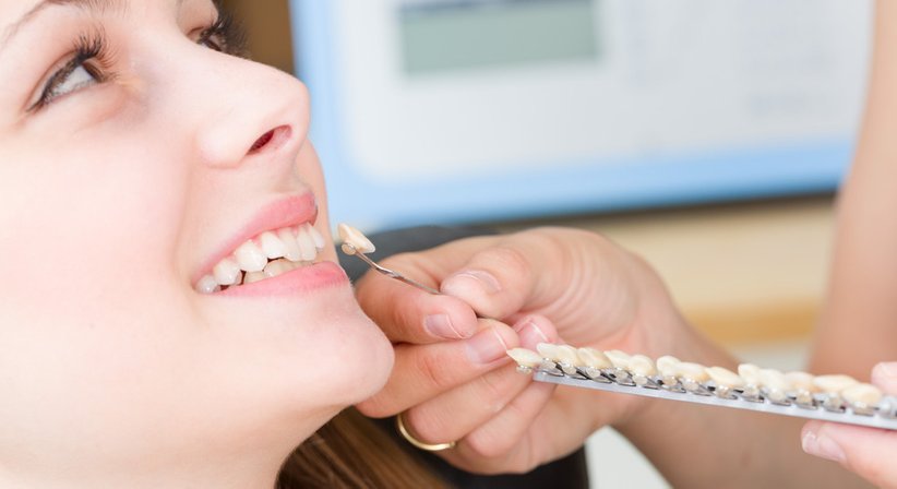 Veneers - Dr. Andreas Zimmermann - Zahnarzt Rohrbach bei Mattersburg 7222