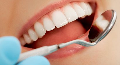 Professionelle Mundhygiene und Zahnprophylaxe