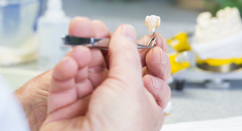 Inlays / Onlays - Ing. Dr. Gernot Blabensteiner - Zahnarzt Schweiggers 3931