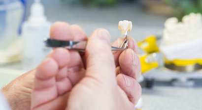 Keramische Versorgungen