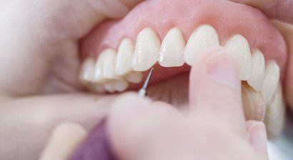 Prothetische Versorgung (Teil- und Vollprothesen)