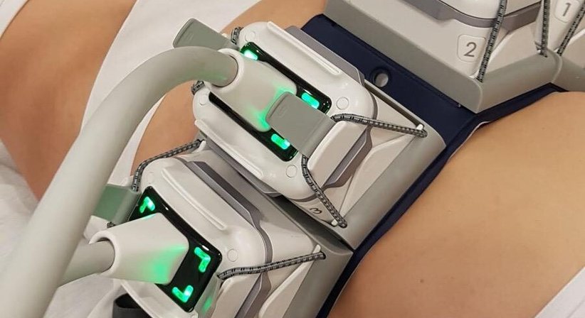 Venus Bliss® (Fettweg Laser und Tiefenradiofrequenz für den Körper) bei Dr. med. univ. Mag. art. Hanna Sheu, MPH