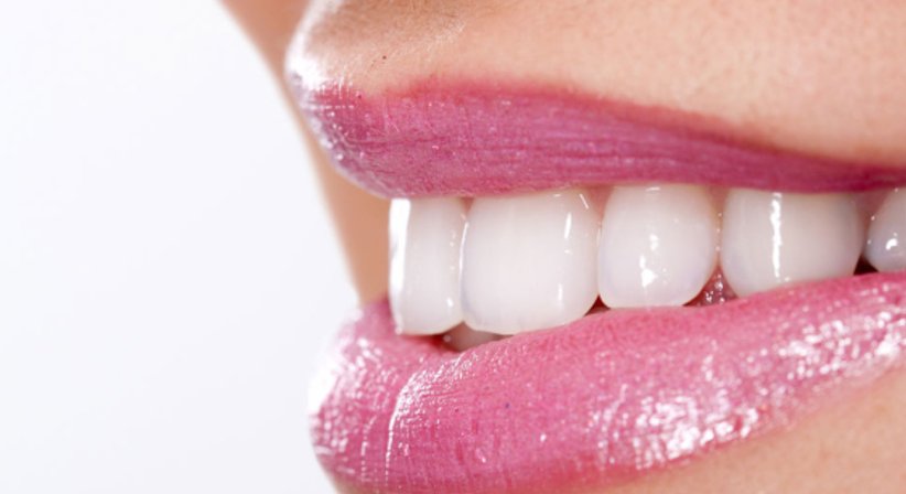 Bleaching - Dr. med. dent. Konstantin Pischel, Msc. - Zahnarzt Linz 4020