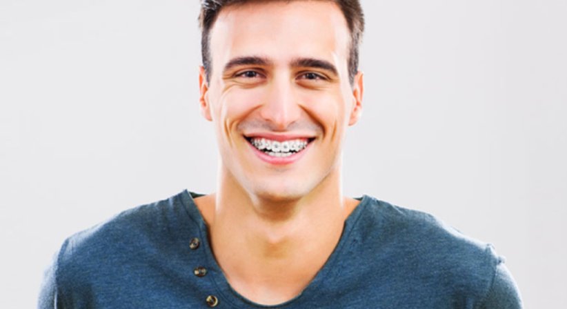 Gratiszahnspange - Dr. med. dent. Konstantin Pischel, Msc. - Zahnarzt Linz 4020