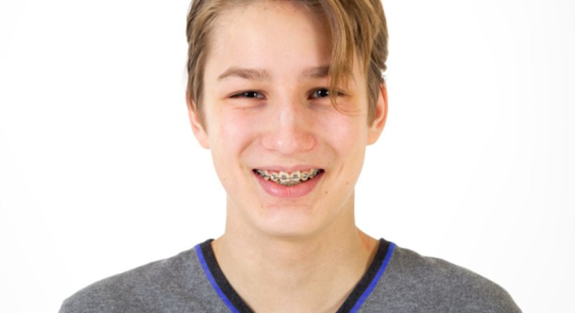 Gratiszahnspange - Dr. med. dent. Konstantin Pischel, Msc. - Zahnarzt Linz 4020