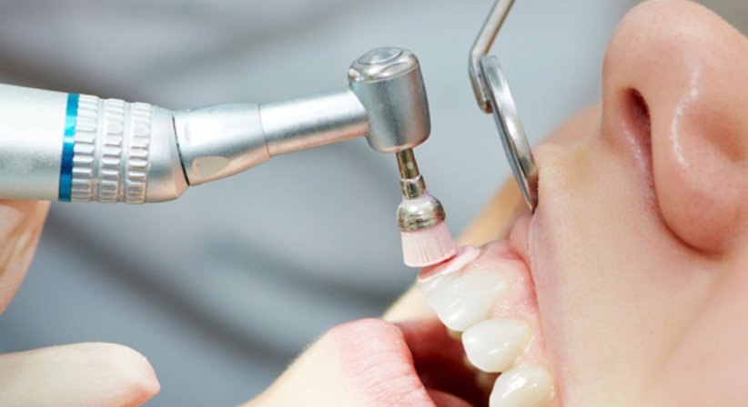 Mundhygiene - Dr. med. dent. Konstantin Pischel, Msc. - Zahnarzt Linz 4020