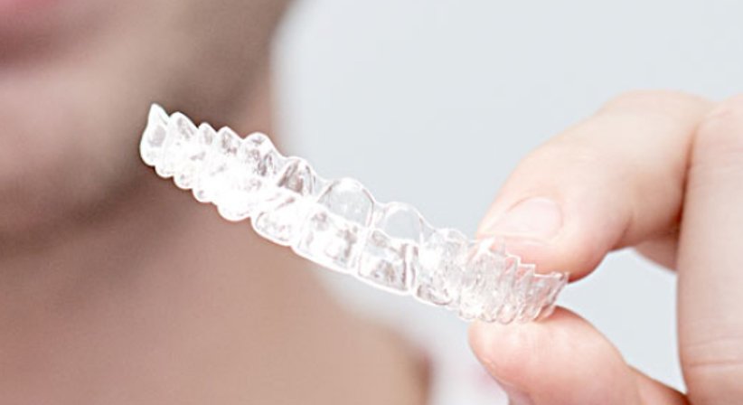 Unsichtbare Zahnspange - Dr. med. dent. Konstantin Pischel, Msc. - Zahnarzt Linz 4020