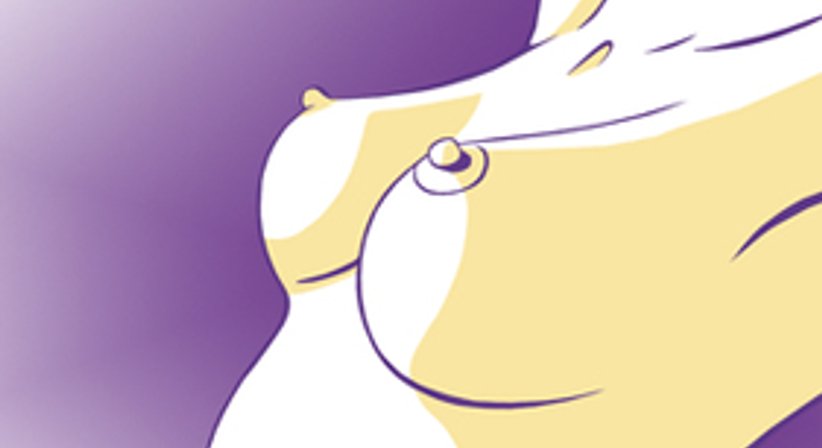 Bruststraffung / Brustverkleinerung - Dr. Alexander Siegl - Plastischer Chirurg Linz 4020