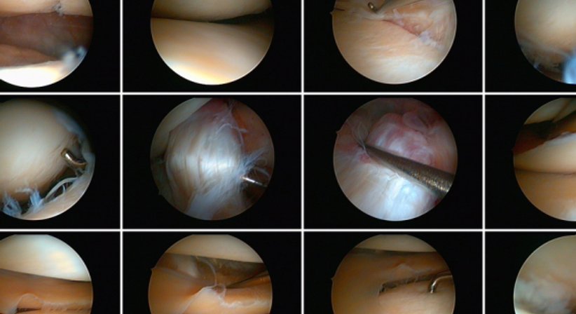 Arthroskopie (Knie, Ellenbogen und Handgelenk) - OA Priv.-Doz. Dr. Sebastian Farr - Orthopäde Wien 1010