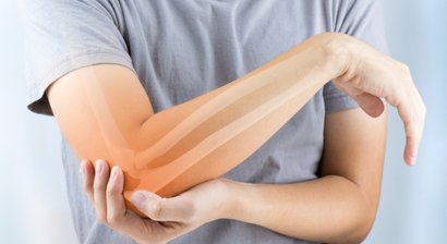 Sulcus nervi ulnaris Syndrom