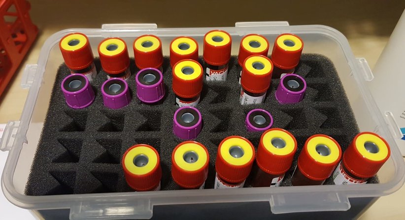 Infusionstherapie (z.B. bei Hörsturz, Ohrgeräuschen und Schwindel) - Dr. Andrea Vogel - HNO-Ärztin Wien 1130