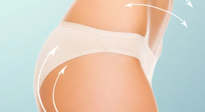 Hautstraffung - Priv.-Doz. Dr. Johannes Matiasek - Plastischer Chirurg Schladming 8970