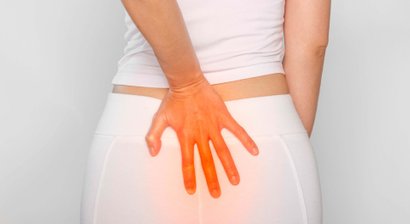 Steißbeinfistel (Sinus piloilonidalis)