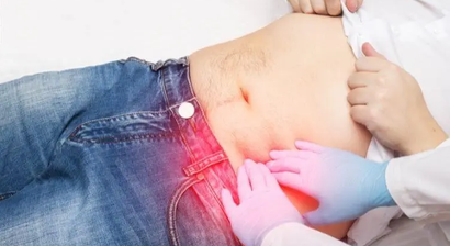 Divertikelerkrankung