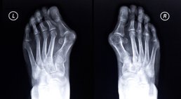 Dr. med. univ. Clemens Carl Wissiak - Orthopäde Deutschlandsberg 8530