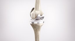 Dr. med. univ. Clemens Carl Wissiak - Orthopäde Deutschlandsberg 8530