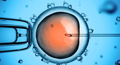 PKD (Polkörperdiagnostik)