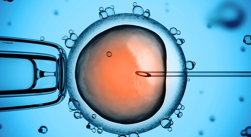 PKD (Polkörperdiagnostik) - Dr. med. Roman Pavlik - Frauenarzt Thalheim bei Wels 4600