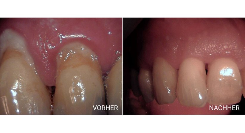 Parodontosetherapie und Orthomolekularen Medizin - Dr. Stefan C. Wilson - Zahnarzt Linz 4020