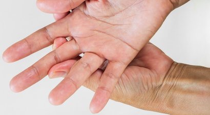 Schnellender Finger (Tendovaginitis stenosans)