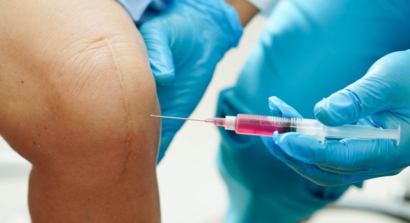 Hyaluronsäure-Infiltrationen bei Dr. Oliver Pieper